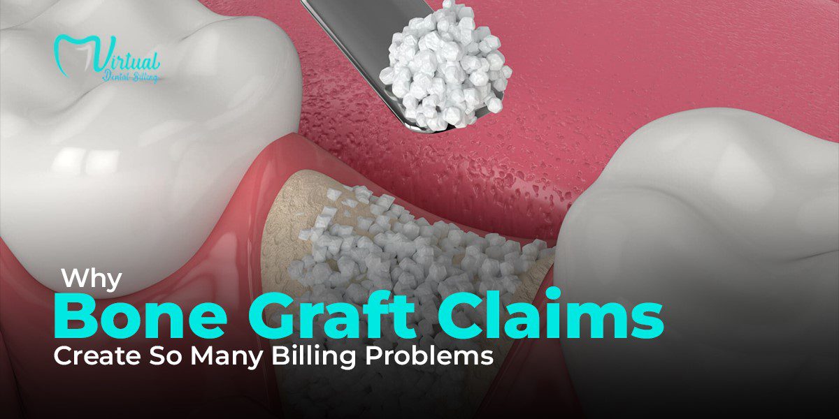 Dental bone graft illustration showing graft material placed in the jawbone with text about billing problems for bone graft claims.